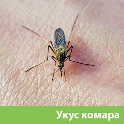 Укусы комаров в Глазове