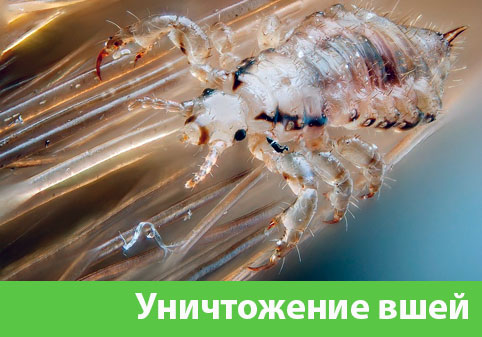 Уничтожение вшей в городе Глазов